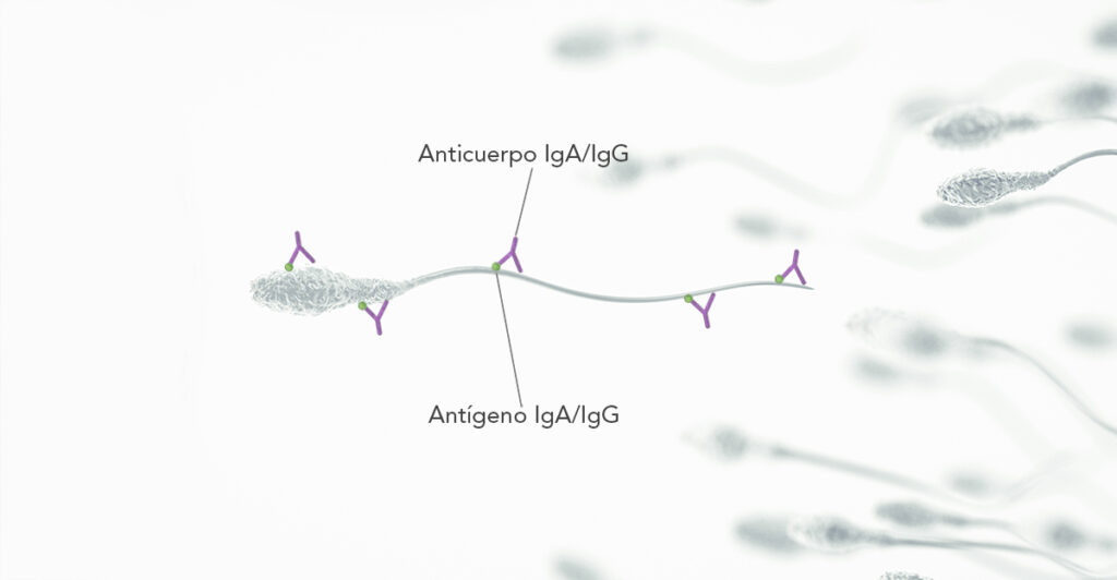 Anticorpi anti-spermatozoi (ASA) Instituto Bernabeu