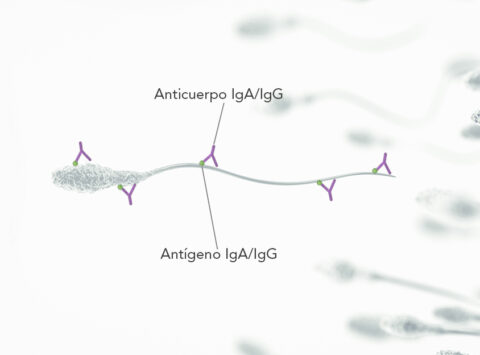 Antisperm antibodies (AAE); What is a myth and what is reality?