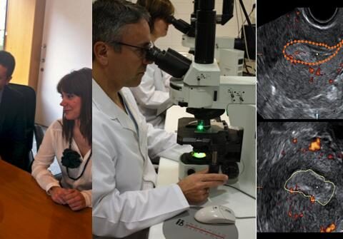 The contribution of array CGH towards treating patients with recurrent implantation failure (RIF)