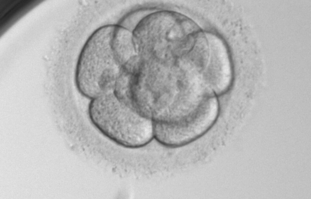 Day 3 embryo cuture