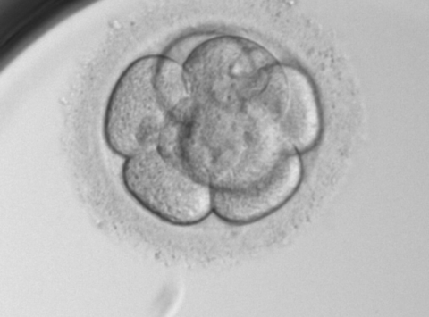 Day 3 embryo cuture