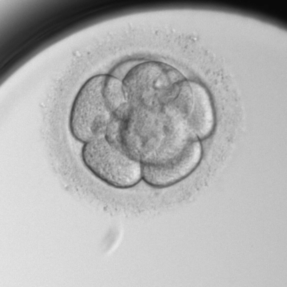 Day 3 embryo cuture - Instituto Bernabeu