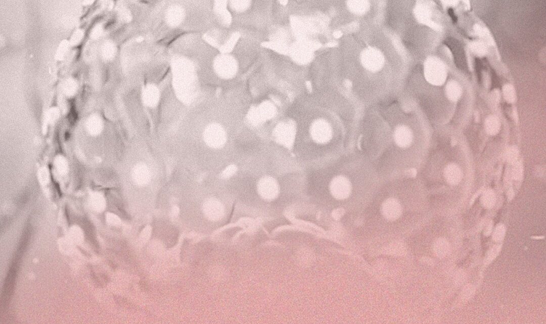 El PGT-A, la biopsia no invasiva y la doble estimulación centran el debate de los especialistas sobre el congreso ESHRE-ASRM 2021