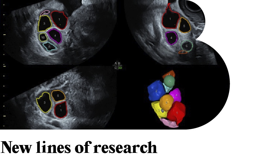 NEW IB NEWSLETTER: New lines of research for low ovarian reserve