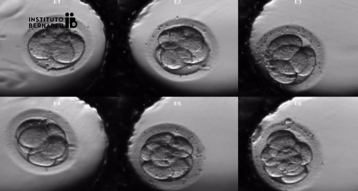 Time-lapse in assisted reproduction. Current situation