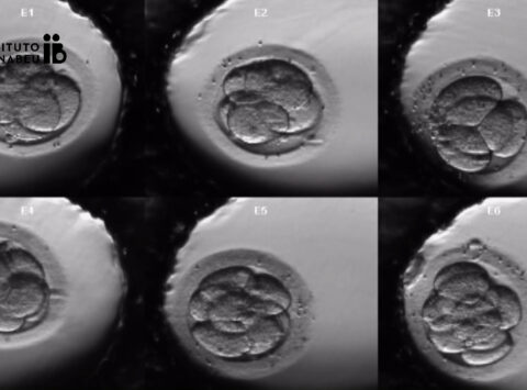 Time-lapse in assisted reproduction. Current situation