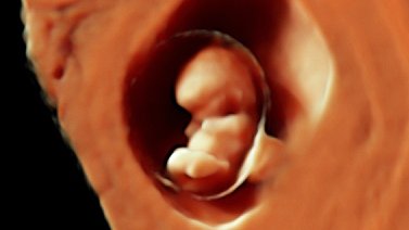 Was ist die Embryonenadoption?