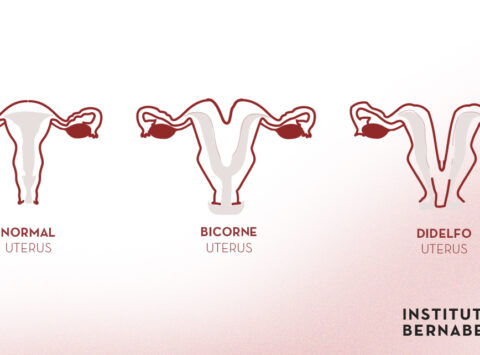 Bicornuate uterus, double uterus or uterus didelphys: what is it? How can it affect fertility and pregnancy?