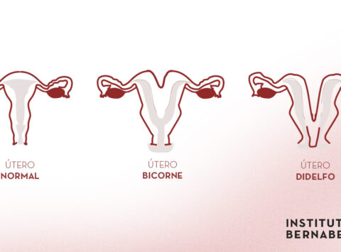 Útero bicorne, doble o didelfo ¿Qué es? ¿Cómo afecta a la fertilidad y al embarazo