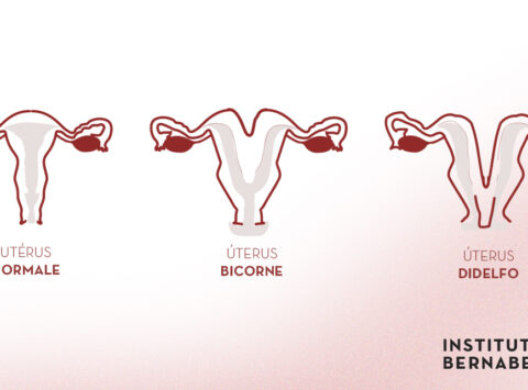 Utérus bicorne, double ou didelphe : Qu’est-ce que c’est ? Comment affecte-t-il la fertilité et la grossesse ?