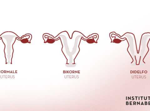 Zweispitzige Gebärmutter, doppelte Gebärmutter oder Uterus didelphys, was ist das? Wie beeinträchtigt sie die Fruchtbarkeit und die Schwangerschaft?