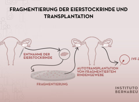 Ovarielle Verjüngung durch Fragmentierung und Transplantation von ovarieller Rinde