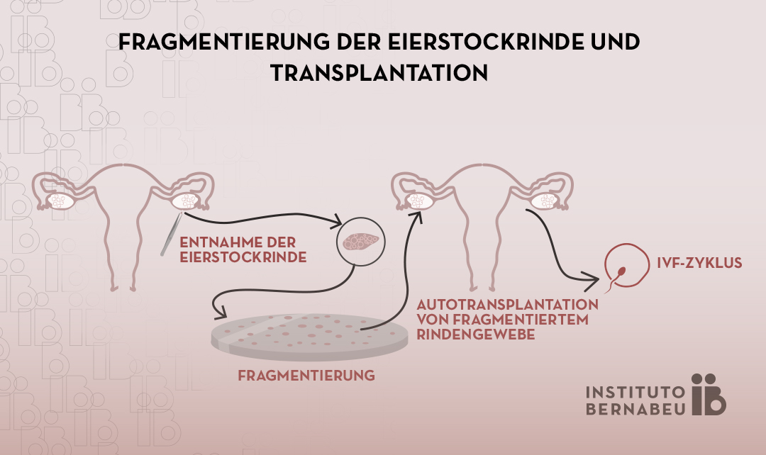 Ovarielle Verjüngung durch Fragmentierung und Transplantation von ovarieller Rinde