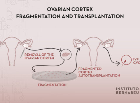 Ovarian rejuvenation through fragmentation and transplantation of ovarian cortex