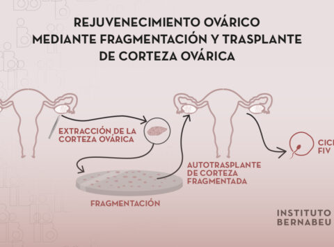 Rejuvenecimiento ovárico mediante fragmentación y trasplante de corteza ovárica