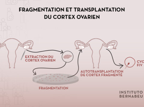 Rajeunissement des ovaires par la fragmentation et la greffe de cortex ovarien