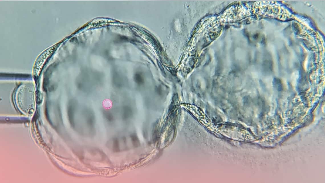 Pregnancy outcomes improve after «artificially collapsing» the embryo before freezing. A new study presented at ESHRE 2021