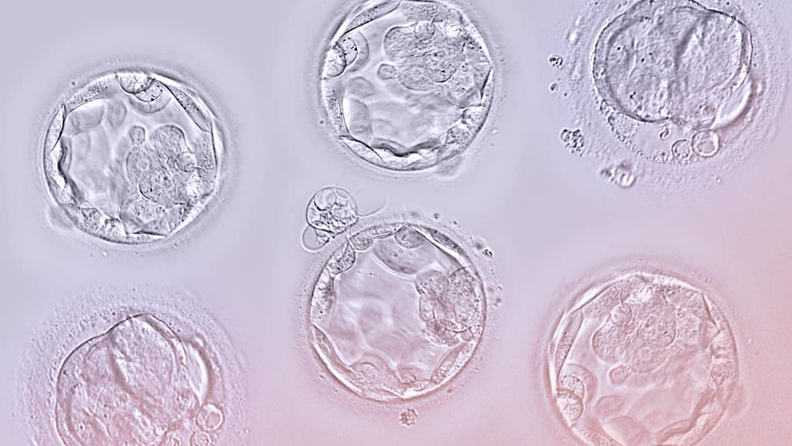 What is an embryo bank?