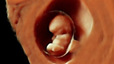 الكشف بالموجات فوق الصوتية عند الحمل