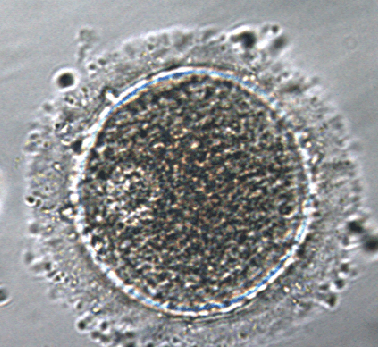 Ovocitos: Tipos y capacidad de desarrollo embrionario - Instituto Bernabeu