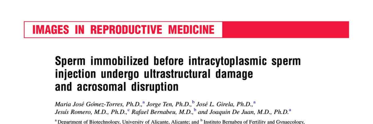 Sperm immobilized before intracytoplasmic sperm injection undergo ultrastructural damage and acrosomal disruption