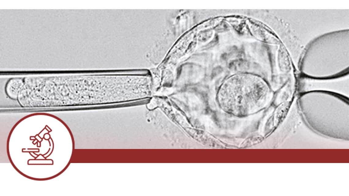 Estudio comparativo entre las técnicas de biopsia de trofoectodermo “pulling” y “flicking” en ciclos de PGD