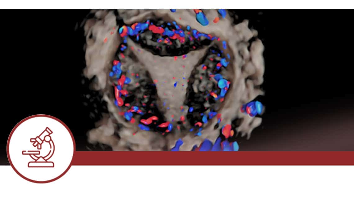 Efecto de la preparación endometrial y estatus cromosómico embrionario sobre los resultados clínicos tras criotransferencia
