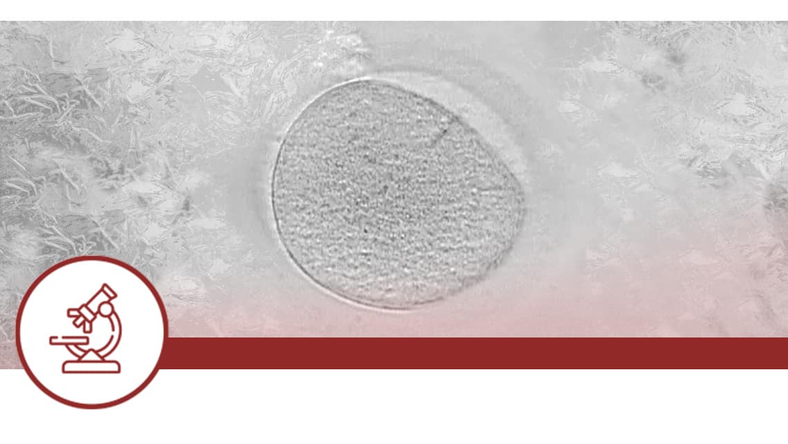 Effect of pre-vitrification embryo collapse on clinical outcomes after cryotransfer