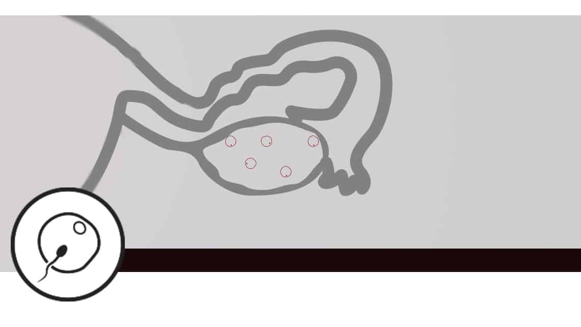 Subluteal study in low ovarian response