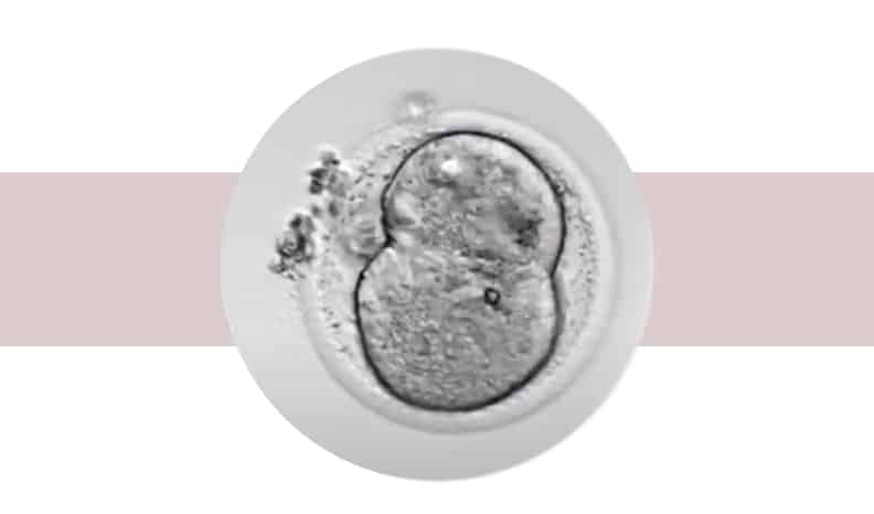 Preimplantation genetic diagnosis without biopsy non-invasive: niPGT-A