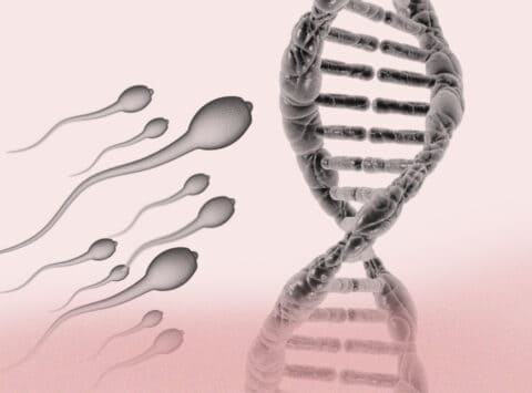 Schwerer männlicher Faktor: Gibt es eine genetische Ursache?