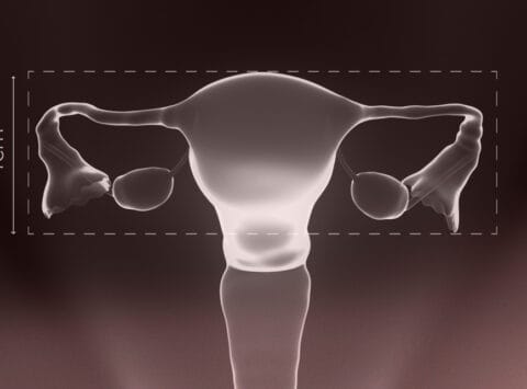 Qu’est-ce que l’utérus infantile ? Quelles sont les chances de grossesse?