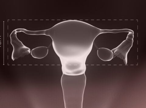 What is the infantile uterus and what are the possibilities of pregnancy?