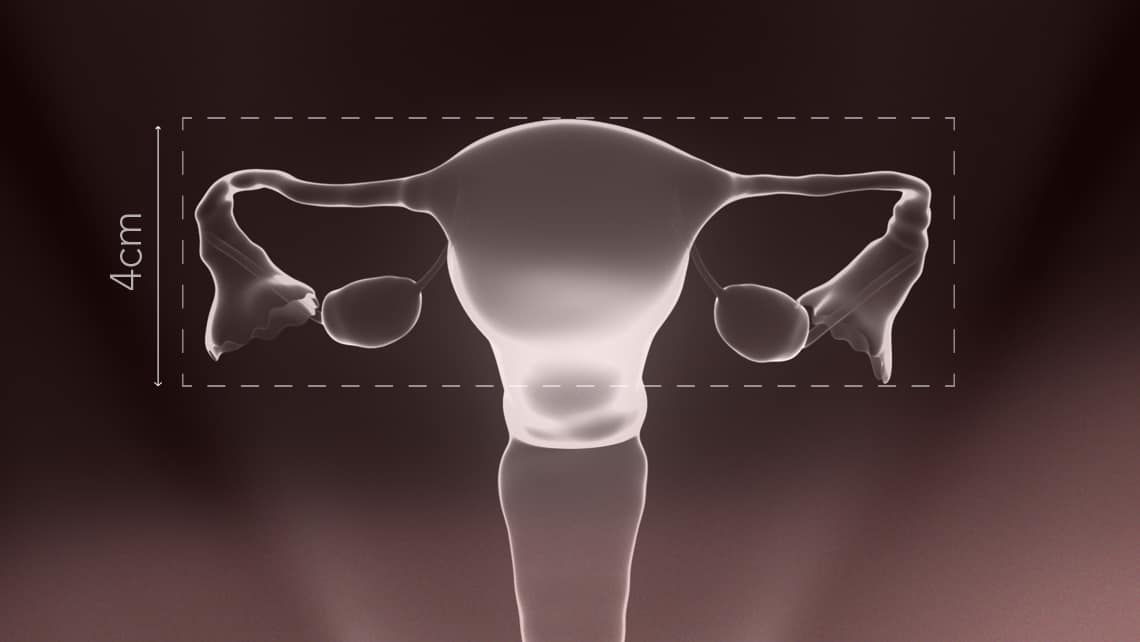 What is the infantile uterus and what are the possibilities of pregnancy?