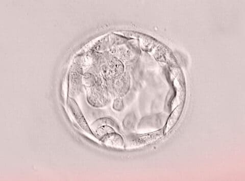 Presentiamo un nuovo studio sulla tecnica di biopsia non invasiva dell’embrione presso il congresso ASEBIR