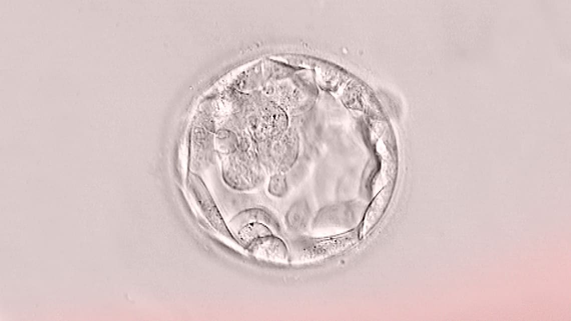 Wir präsentieren eine neuartige Studie über die Technik der nicht invasiven Biopsie des Embryos auf dem Kongress der ASEBIR
