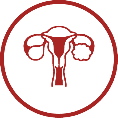 La obesidad se asocia a alteraciones menstruales, con mayor frecuencia por la presencia del síndrome de ovarios poliquísticos