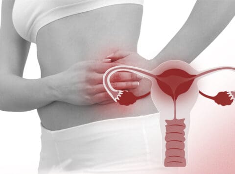 Welche Auswirkungen hat eine Beckenentzündung (PID) auf das Schwangerwerden?