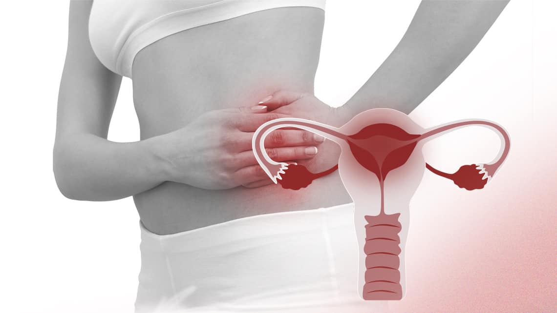 Welche Auswirkungen hat eine Beckenentzündung (PID) auf das Schwangerwerden?