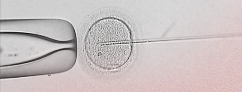 ICSI: Intracytoplasmic sperm injection 