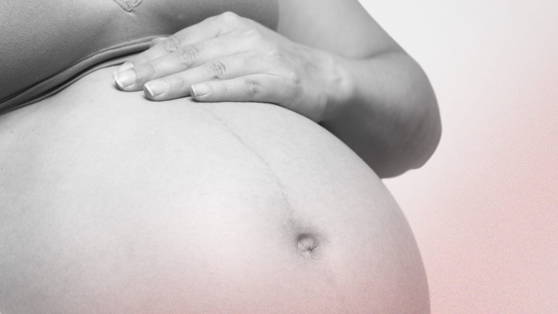 How do I know if I am leaking amniotic fluid in pregnancy?