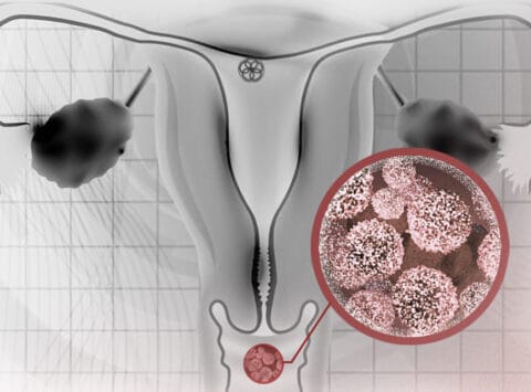 Scientific Reports greift eine Studie des Instituto Bernabeu über die Merkmale des vaginalen Mikrobioms bei schwangeren Frauen auf