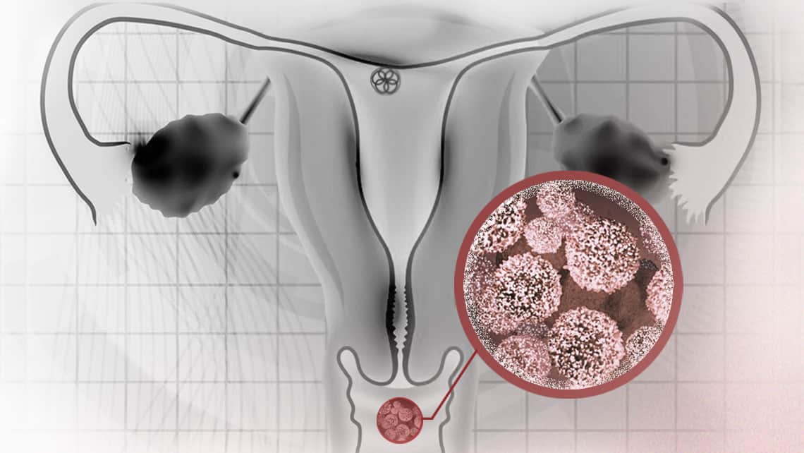Scientific Reports greift eine Studie des Instituto Bernabeu über die Merkmale des vaginalen Mikrobioms bei schwangeren Frauen auf
