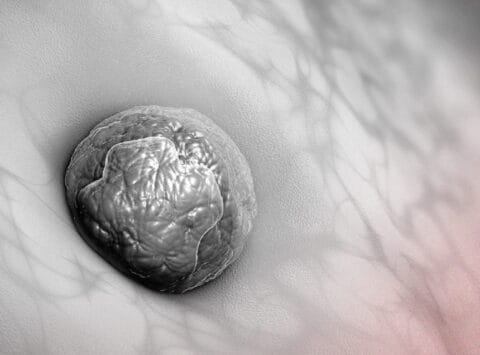 What are the main causes of embryo implantation failure? 