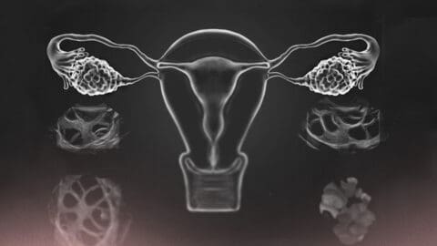 Je ne réponds pas à la stimulation ovarienne dans un cycle de fécondation in vitro (FIV). Que puis-je faire ?