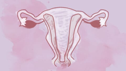 Septate Uterus: what it is, how it is diagnosed, and its treatment