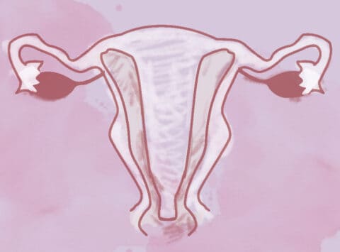 Septate Uterus: what it is, how it is diagnosed, and its treatment