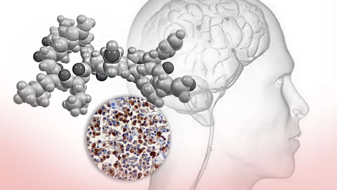 What is luteinising hormone (LH)? Understand its function and optimum levels in the search for pregnancy