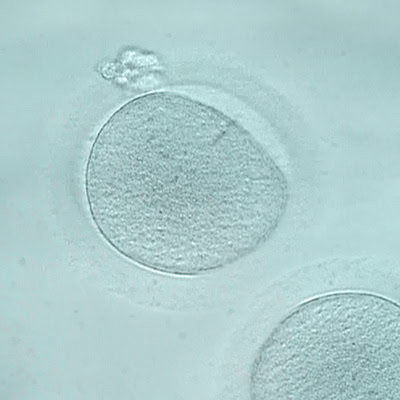 SPECIALISED UNIT IN OOCYTES CRYOPRESERVATION