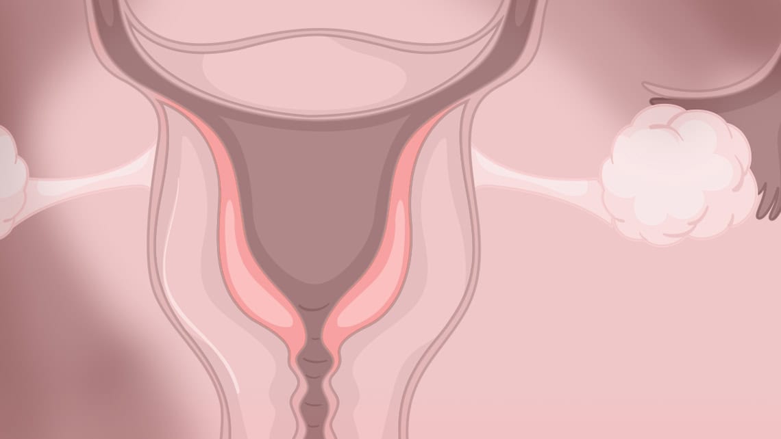 Cómo se diagnostica la endometriosis: pruebas médicas y tiempos